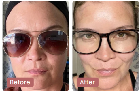 Heather O. before and after