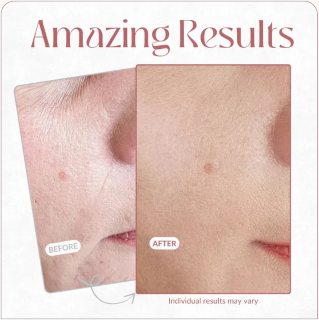 Amazing Results β Before and After